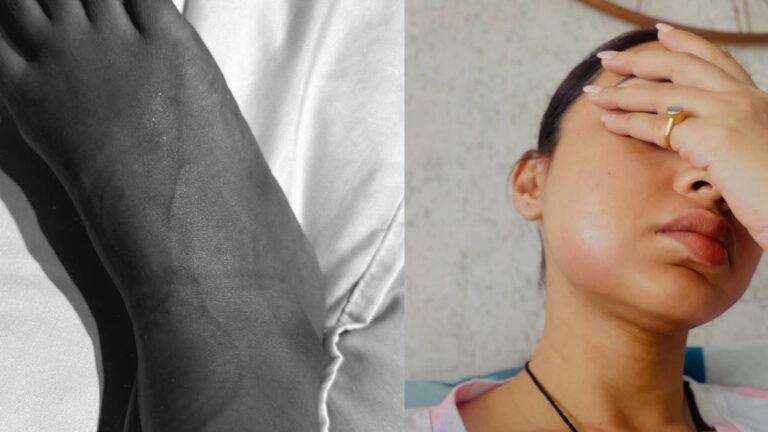 सूजा मुंह, होंठ पर घाव और पैर में चोट, मिमी चक्रवर्ती की तस्वीरें देख चिंता में पड़े फैंस, एक्ट्रेस ने बताया कैसे हुआ ये हाल