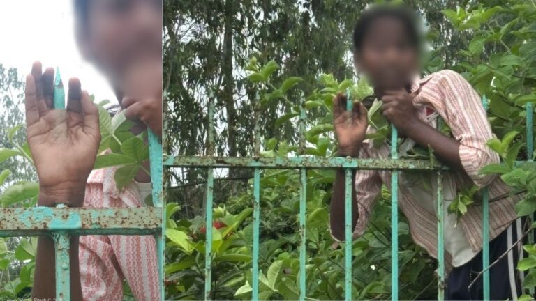 लोहे की ग्रिल पर गिरी फूल तोड़ने गई बच्ची, हाथ में घुस गया सरिया, AIIMS में हुई सर्जरी