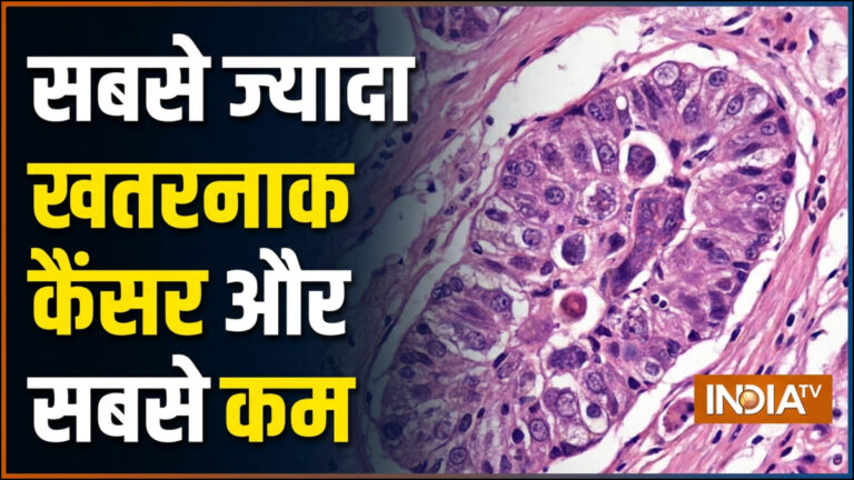 कौन सा कैंसर सबसे ज्यादा खतरनाक माना जाता है और कौन सा कम, फोर्टिस ऑन्कोलॉजिस्ट ने बताया